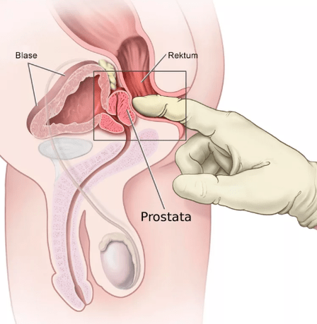 Prostat masajı